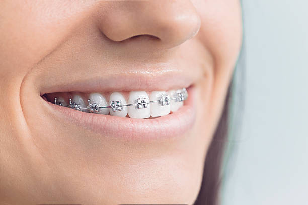 Laser Dentistry in Clarkston Heights Vineland, WA